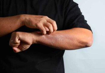 man wondering if his itchy skin is cancer